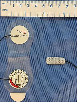 Non-invasive Cardiac Output Monitoring in Neonates